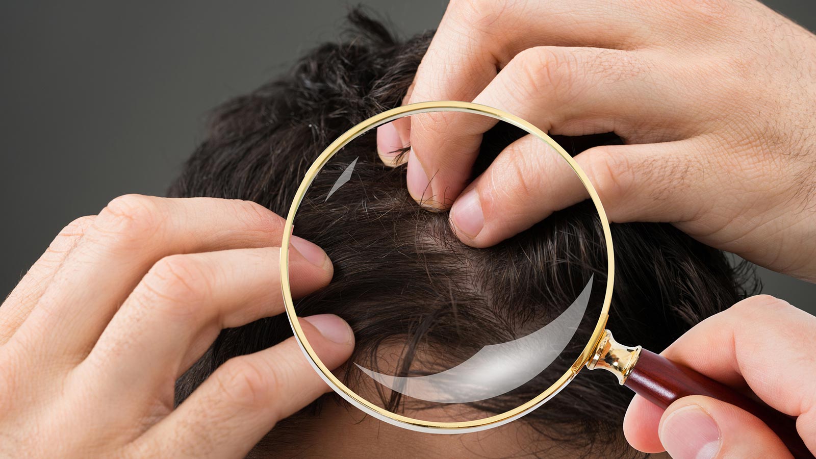 loción capilar cosmética